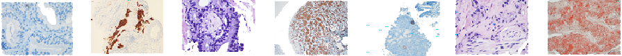 Anatomic pathology laboratory slides